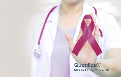VH26 Multisite evaluation of the Asuragen NGS RNA Lung Cancer Kit demonstrates the assay’s superior performance