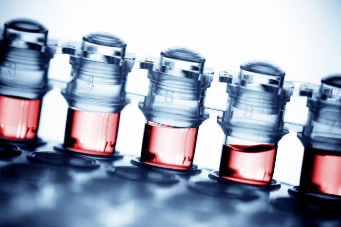 VH28 VH Bio adds high-resolution HLA typing to in-house next-generation sequencing (NGS) service